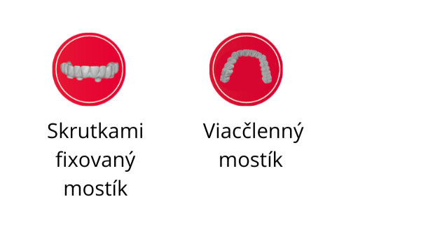AiZir Flash Long Span Bridges – kompatibilný s modernými spekacími pecami