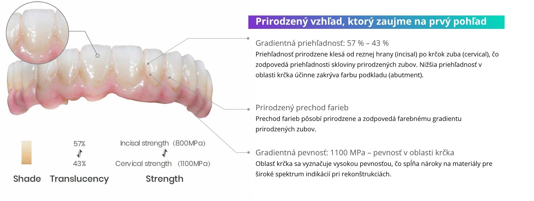 3D Pro Zir viacvrstvový zirkón pre prirodzene vyzerajúci úsmev