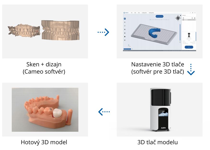 Infinity 5 – pokročilý 3D dentálny skener