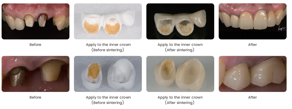 Biomic Opaque Liquid pre dentálne laboratóriá