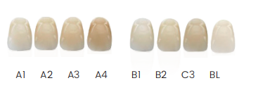 Dentálna živica EZPRINT Crown Bridge 2.0 pre mostíky