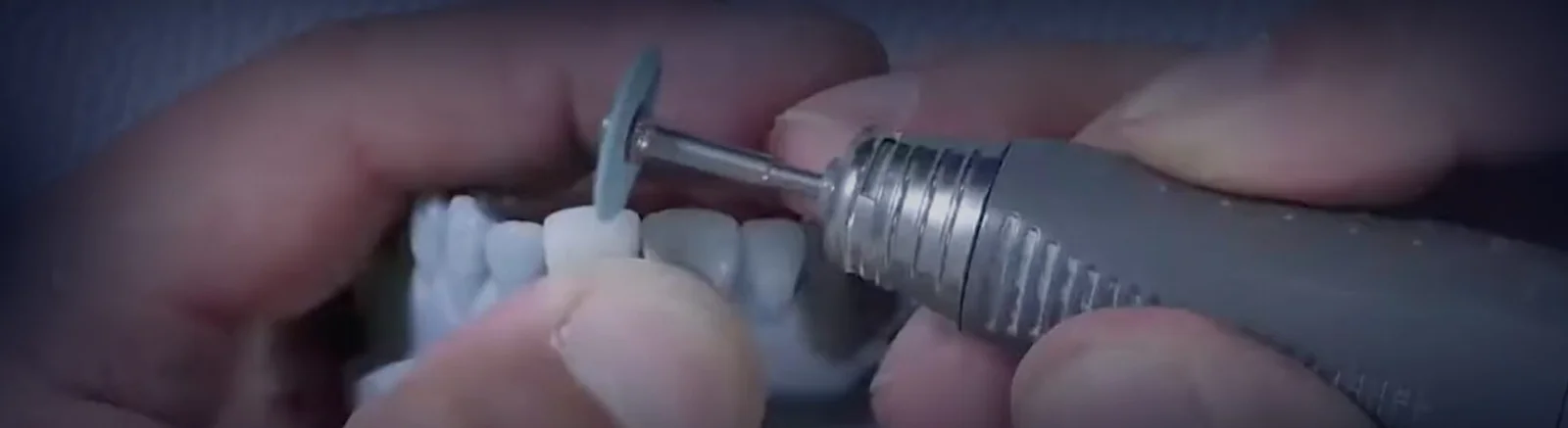 Aidite Hybrid Ceramic Kit na brúsenie a leštenie náhrad